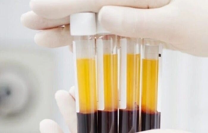 فروش پنهان پلاسمای خون در بازارهای میلیارد دلاری 