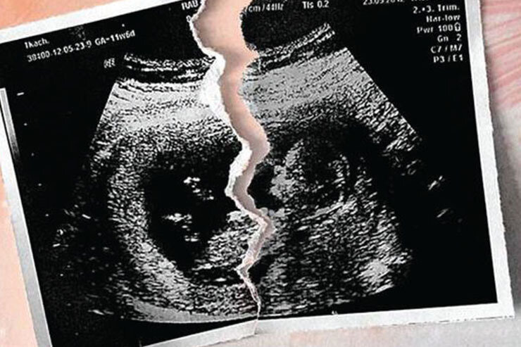 مجازات‌های متخلفان سقط جنین ۱۰۰ درصد بازدارنده است