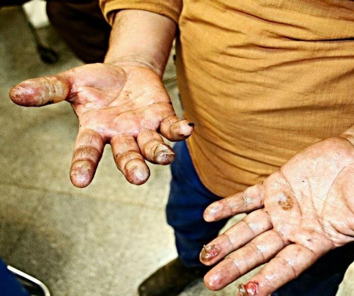 توصیه‌های پیشگیری از حوادث چهارشنبه سوری