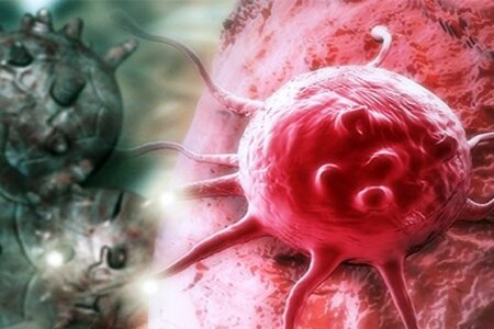 استان یزد رتبه اول تا سوم ابتلا به ۱۰ سرطان‌ شایع کشور را داراست
