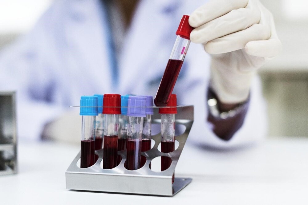 سیستان و بلوچستان نیاز فوری به تمامی گروه‌های خونی دارد
