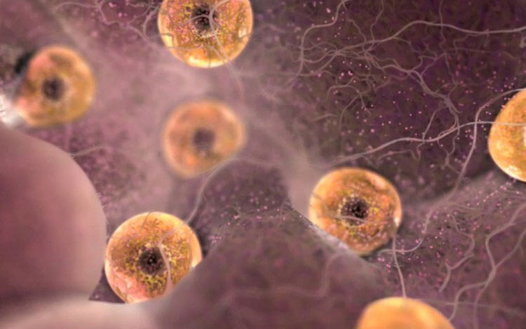 توصیه یک متخصص زنان به دختران جوان برای ذخیره تخمک