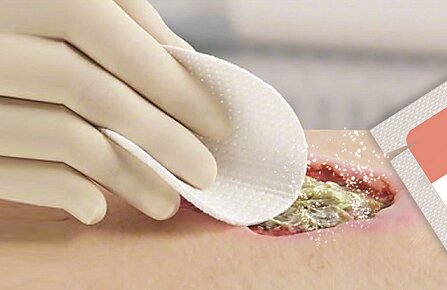 درمان زخم‌های عمیق با پانسمان‌های پودر