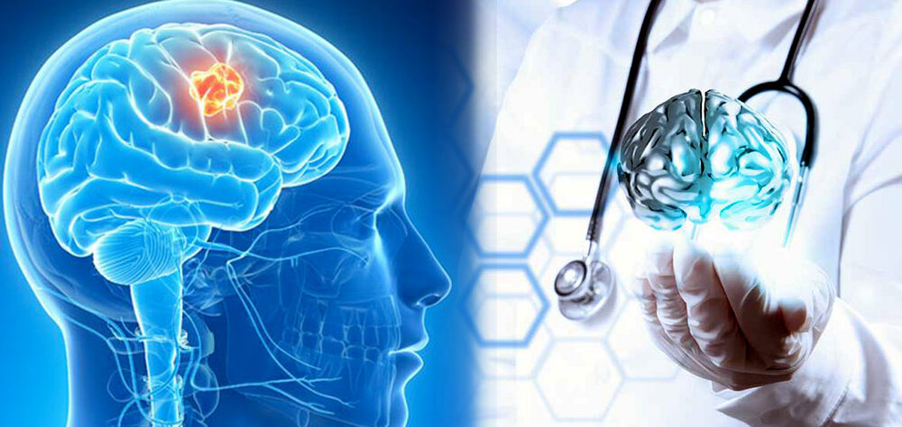 هوش مصنوعی، انقلابی در حوزه سلامت