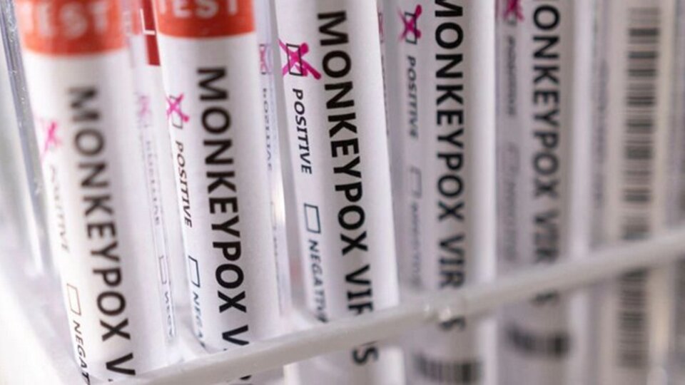 شیوع دوباره آبله‌میمونی در آمریکا