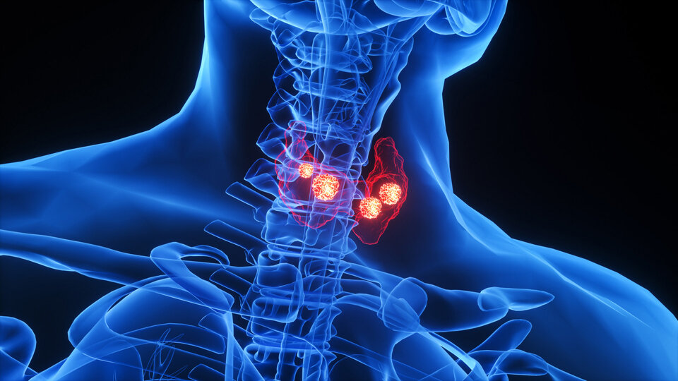 عوارض و نشانه‌های کم‌کاری تیروئید در بدن