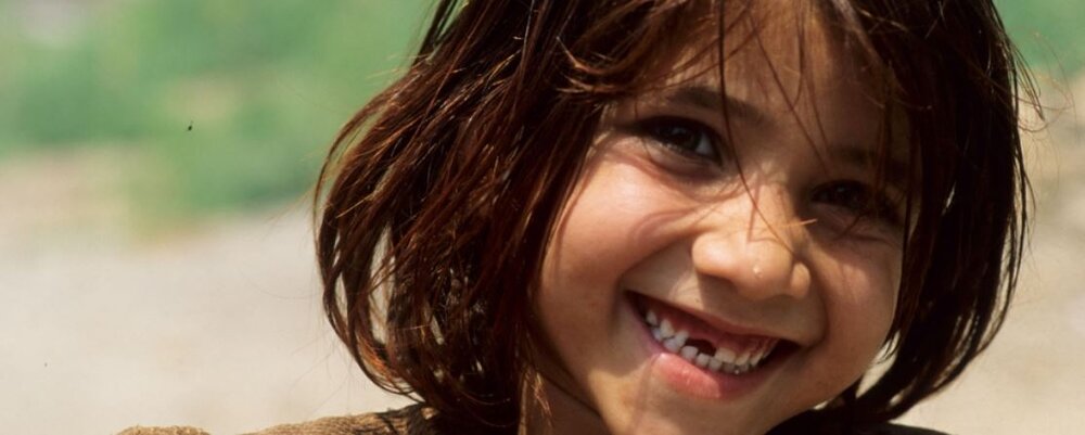 ابتلای نیمی از جمعیت جهان به بیماری‌های دهان و دندان