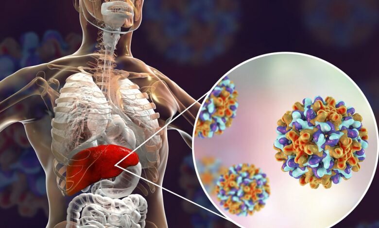 افزایش ۴۰ درصدی ابتلا به هپاتیت در ۶ ماه نخست امسال نسبت به پارسال