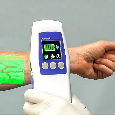 رگ‌یاب هوشمند