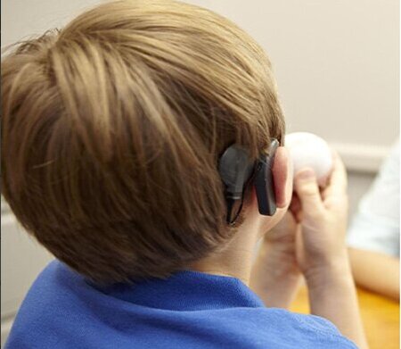 کاشت حلزون رایگان برای کودکان ناشنوای زیر سه سال در زنجان