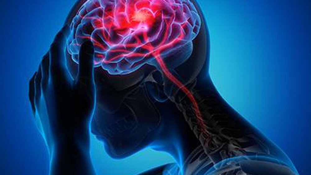 سکته مغزی تا سال ۲۰۵۰ باعث مرگ ۱۰ میلیون نفر در سال خواهد شد