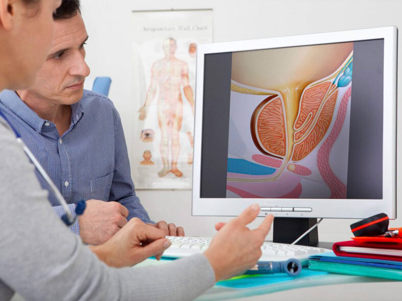 راه‌های پیشگیری از سرطان پروستات