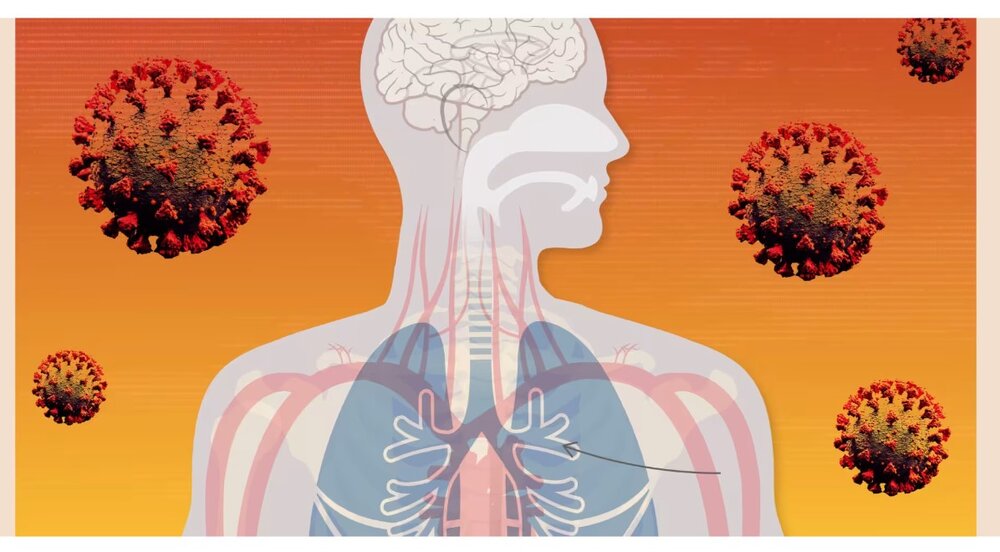 معمای کووید طولانی مدت