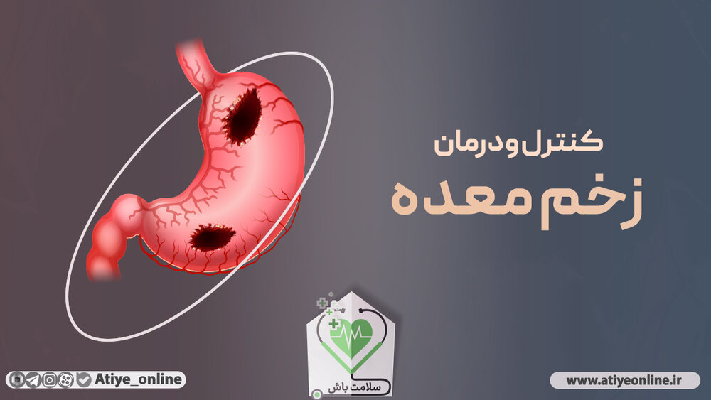 راه‌کارهای درمان زخم معده / قسمت دوم