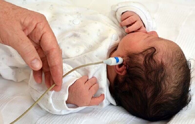 غربالگری شنوایی بیش از ۱۰ هزار نوزاد در زنجان