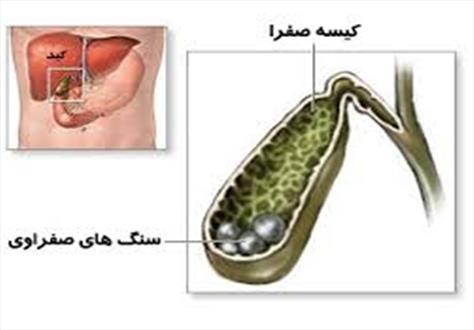«رژیم ۵ روزه غذایی» برای پاکسازی بدن