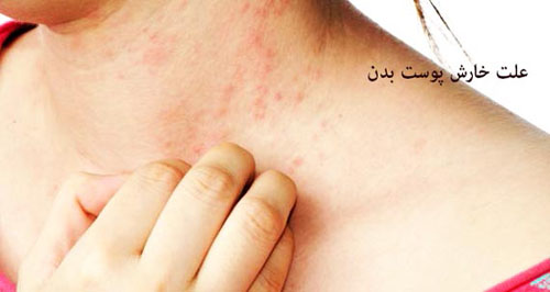 خارش مثل خمیازه مسری است
