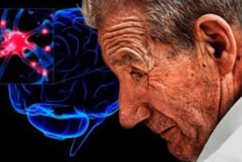 رتبه بالای احتمال مرگ ناشی از پارکینسون در مشاغل عالی