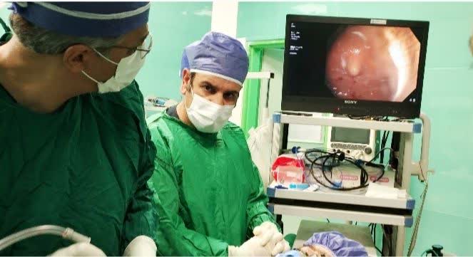 عمل موفقیت‌آمیز خروج جسم خارجی از معده در بیمارستان سردار سلیمانی ابهر