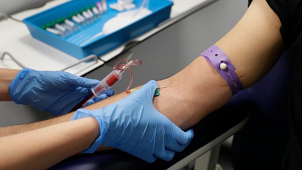 بحران خاموش اچ‌آی‌وی در اروپا؛ افزایش موارد بدون تشخیص و تشخیص دیرهنگام