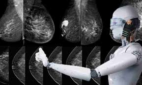 تشخیص زودرس سرطان‌ به کمک هوش مصنوعی