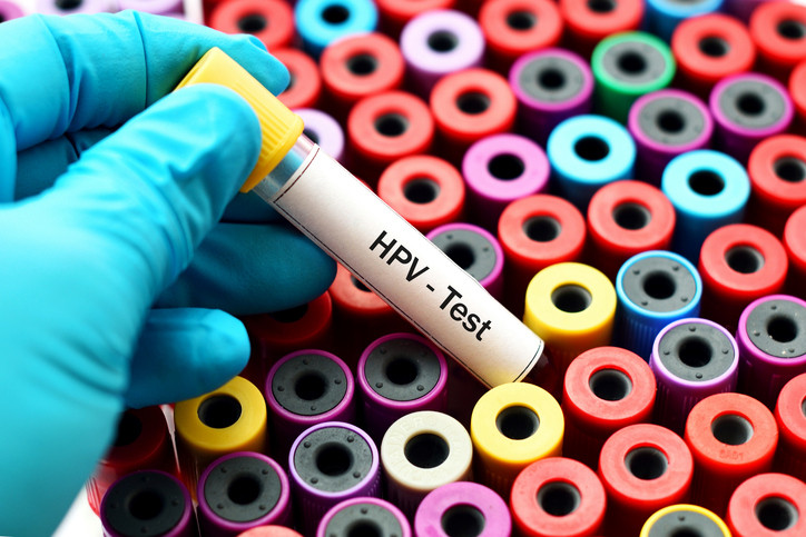 ریشه‌کنی سرطان دهانه رحم بدون واکسیناسیون عمومی HPV ممکن نیست