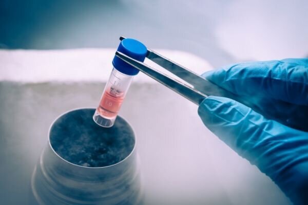 افزایش سن ازدواج؛ پیشنهاد بیمه فریز تخمک به وزارت بهداشت ارائه شد