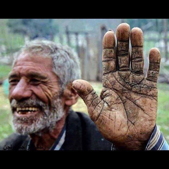 ترک‌های روی دست