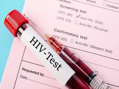 راه‌اندازی شبکه تحقیقات و فناوری HIV