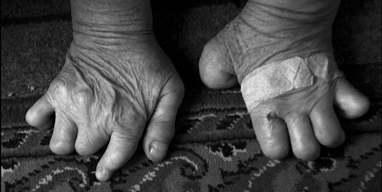 هیولاسازی از تفاوت؛ نگاهی به مواجهه با معلولیت در ایران