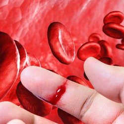 درخواست تشکیل کمیته ویژه برای عبور از بحران داروهای انعقادی