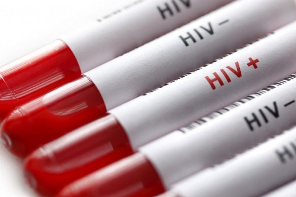 تغییر الگوی انتقال HIV در ایران؛ سهم انتقال جنسی بیشتر شده است