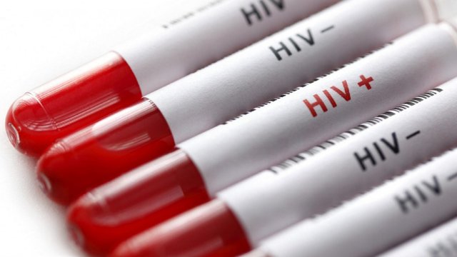 تغییر الگوی انتقال HIV در ایران؛ سهم انتقال جنسی بیشتر شده است
