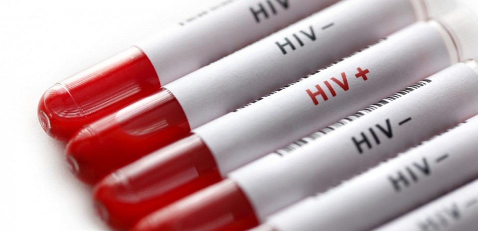 داروی خوراکی جدید HIV از نخستین آزمون بالینی سربلند بیرون آمد