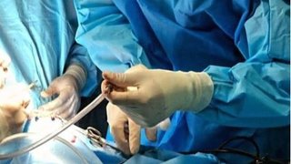 افزایش شکایات جراحی زیبایی غیرمجاز