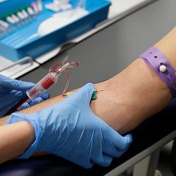 بحران خاموش اچ‌آی‌وی در اروپا؛ افزایش موارد بدون تشخیص و تشخیص دیرهنگام