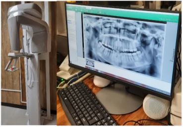 توسعه خدمات درمانی تأمین‌اجتماعی رفسنجان با راه اندازی دستگاه OPG