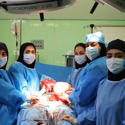 خارج کردن توده ۴ کیلویی از شکم زن ۴۶ ساله