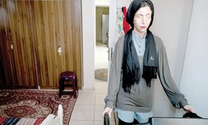 نیمه تاریک اسیدپاشی؛ از طرد اجتماعی تا خلأهای قانونی