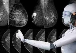 تشخیص زودرس سرطان‌ به کمک هوش مصنوعی