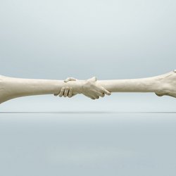 نشست پیشگیری از پوکی استخوان ۱۴۰۵ برگزار شد