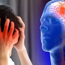 راهکاری برای نجات جان بیمار سکته مغزی
