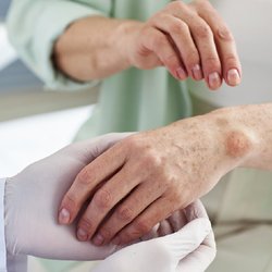 دانشمندان در آستانه‌ی مهار لوپوس