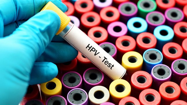 ریشه‌کنی سرطان دهانه رحم بدون واکسیناسیون عمومی HPV ممکن نیست