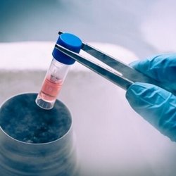 افزایش سن ازدواج؛ پیشنهاد بیمه فریز تخمک به وزارت بهداشت ارائه شد