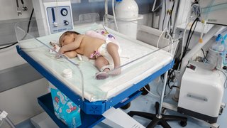 نجات ۷۵ هزار نوزاد از عقب‌ماندگی ذهنی با غربالگری تیروئید