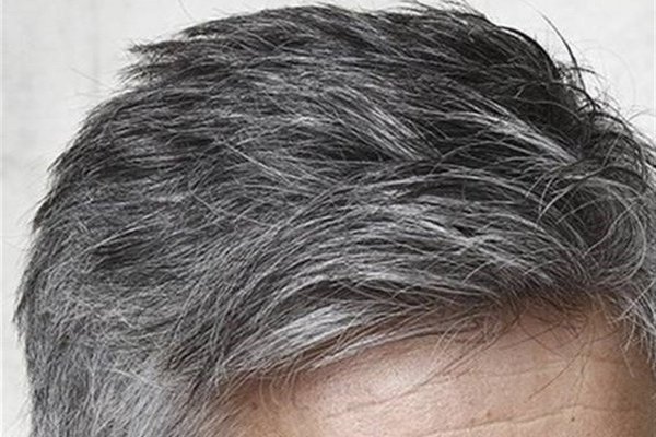 سفید شدن مو و پیر شدن؛ دو روی یک فرآیند دفاعی