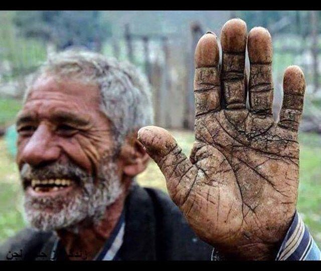 ترک‌های روی دست