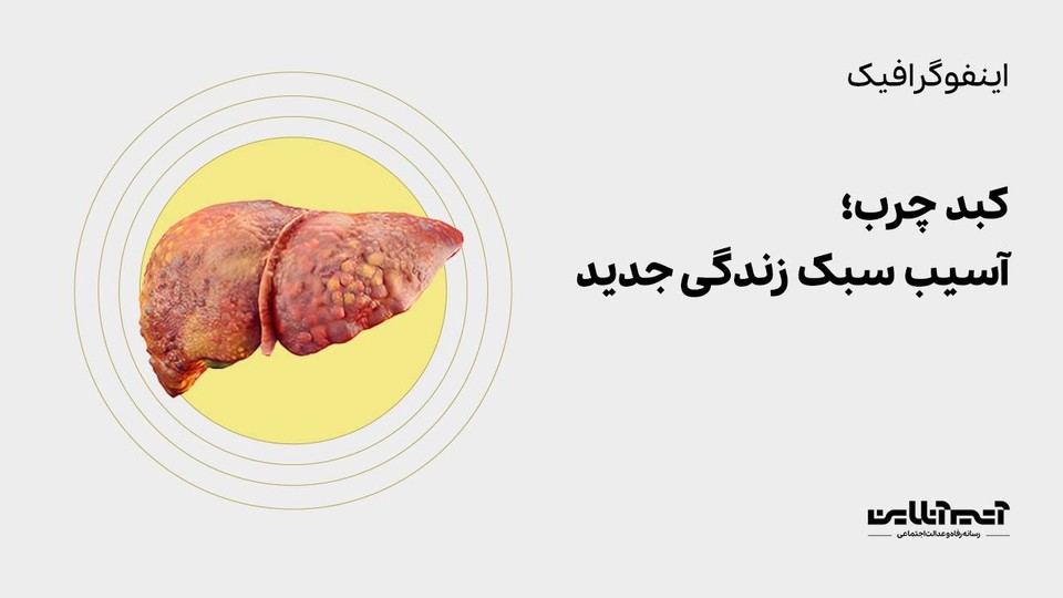 کبد چرب؛ آسیب سبک زندگی جدید