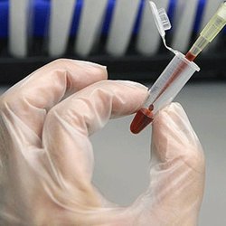 نجات زندگی بیماران خونی و عصبی با سلول‌های بنیادی بند ناف